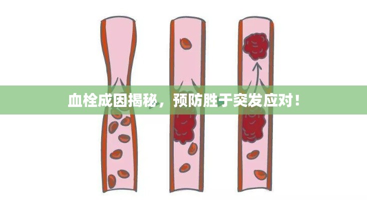 血栓成因揭秘,预防胜于突发应对!